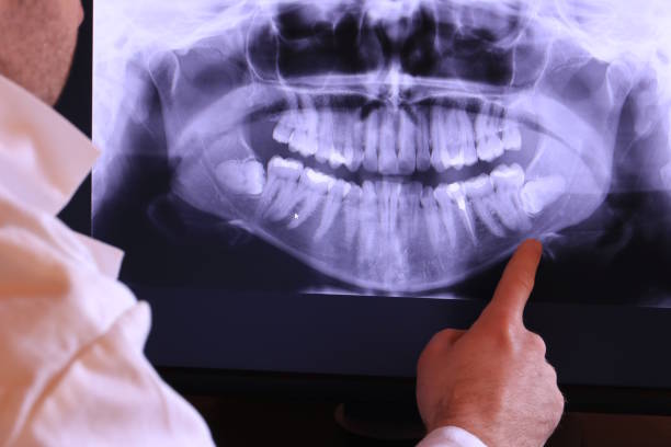 Best Chipped Tooth Repair Near Me  in White City, FL