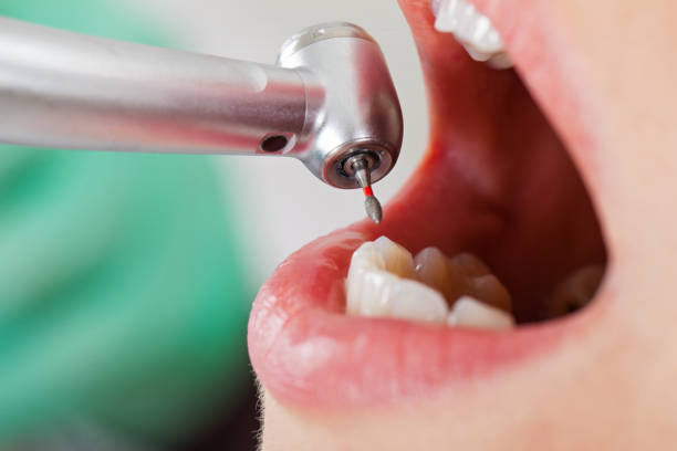 Best Tooth Infection Emergency Dentist  in White City, FL